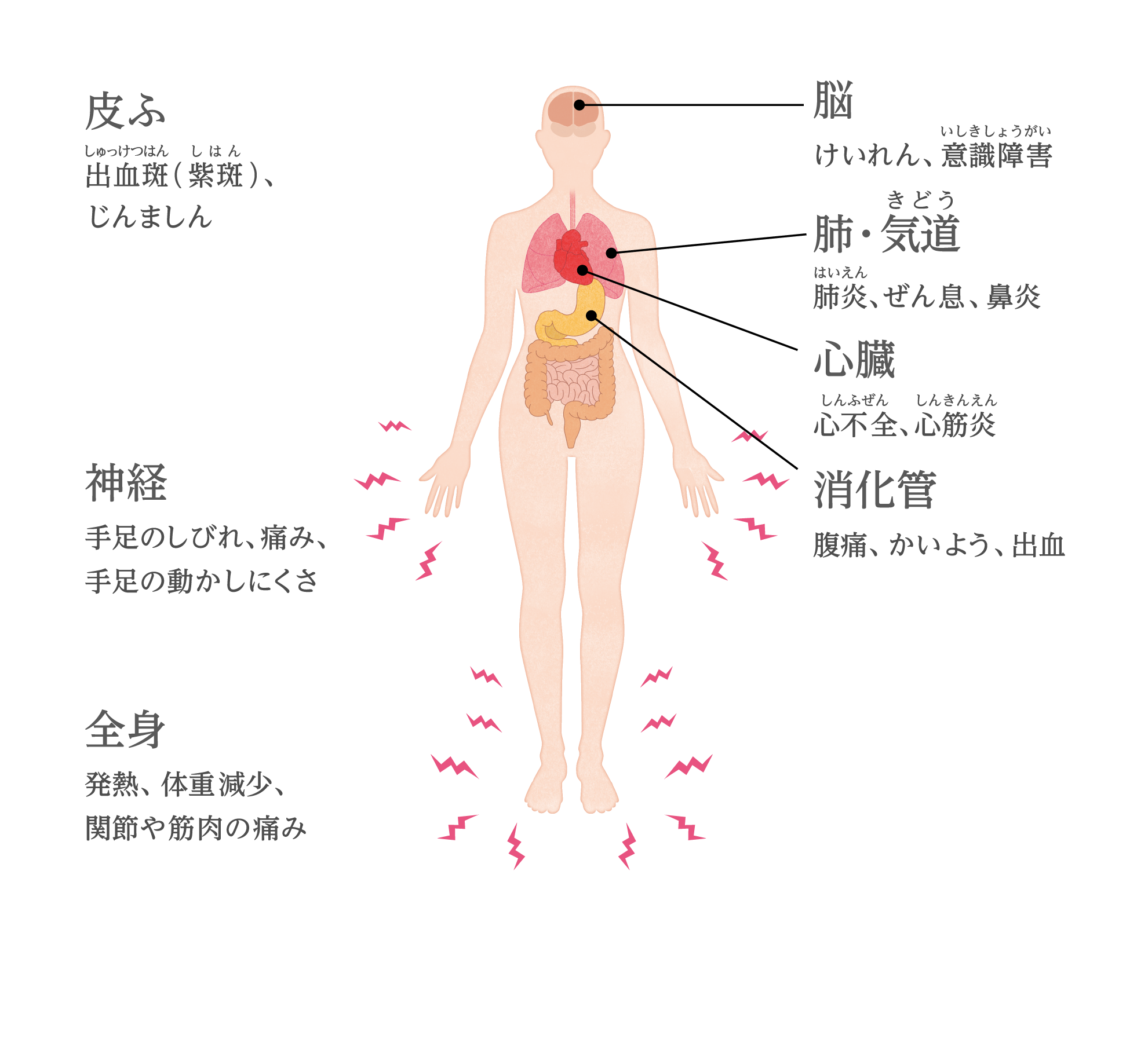 EGPAの主な症状