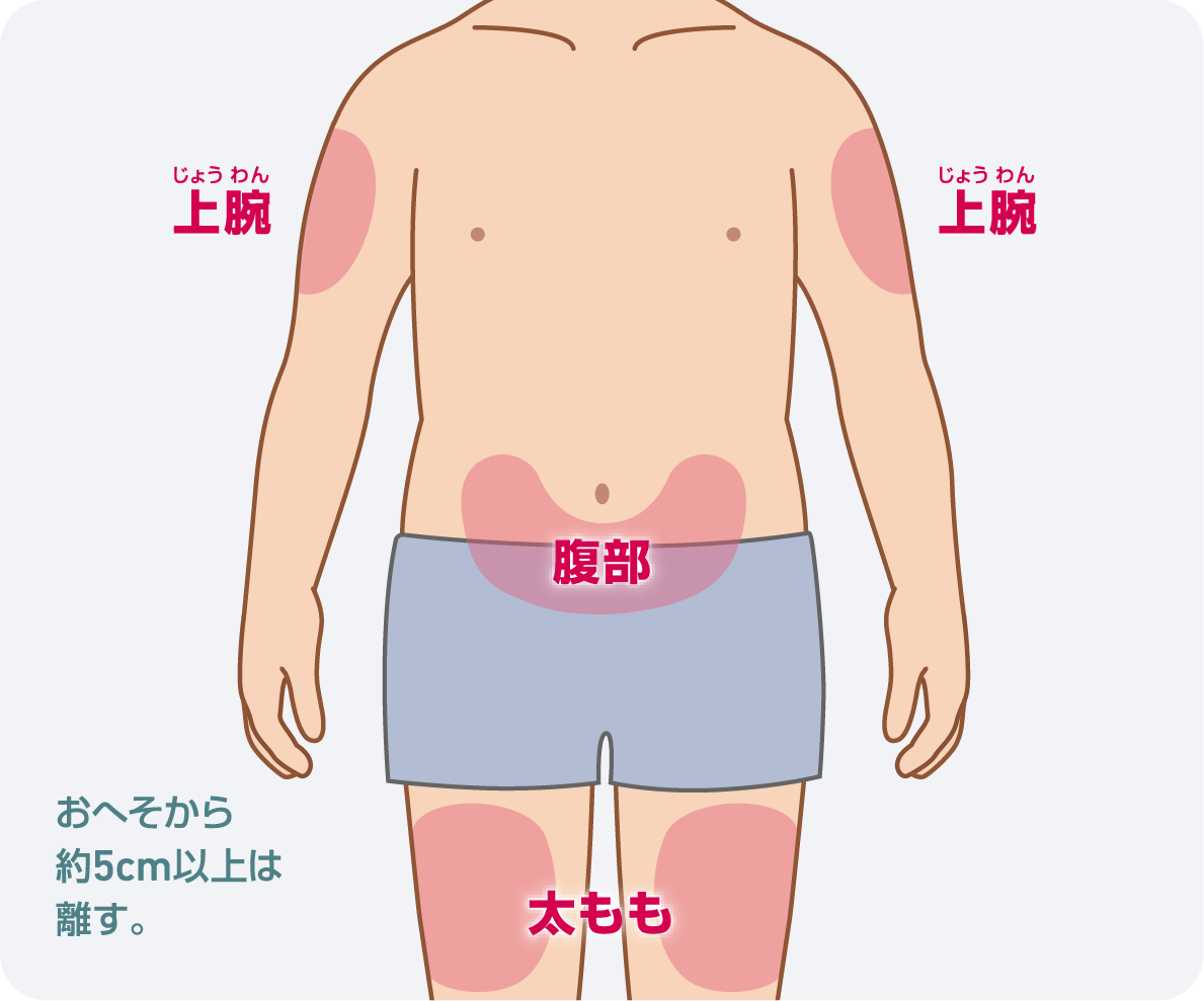 注射部位図