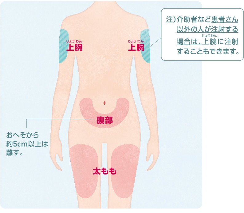 注射部位図