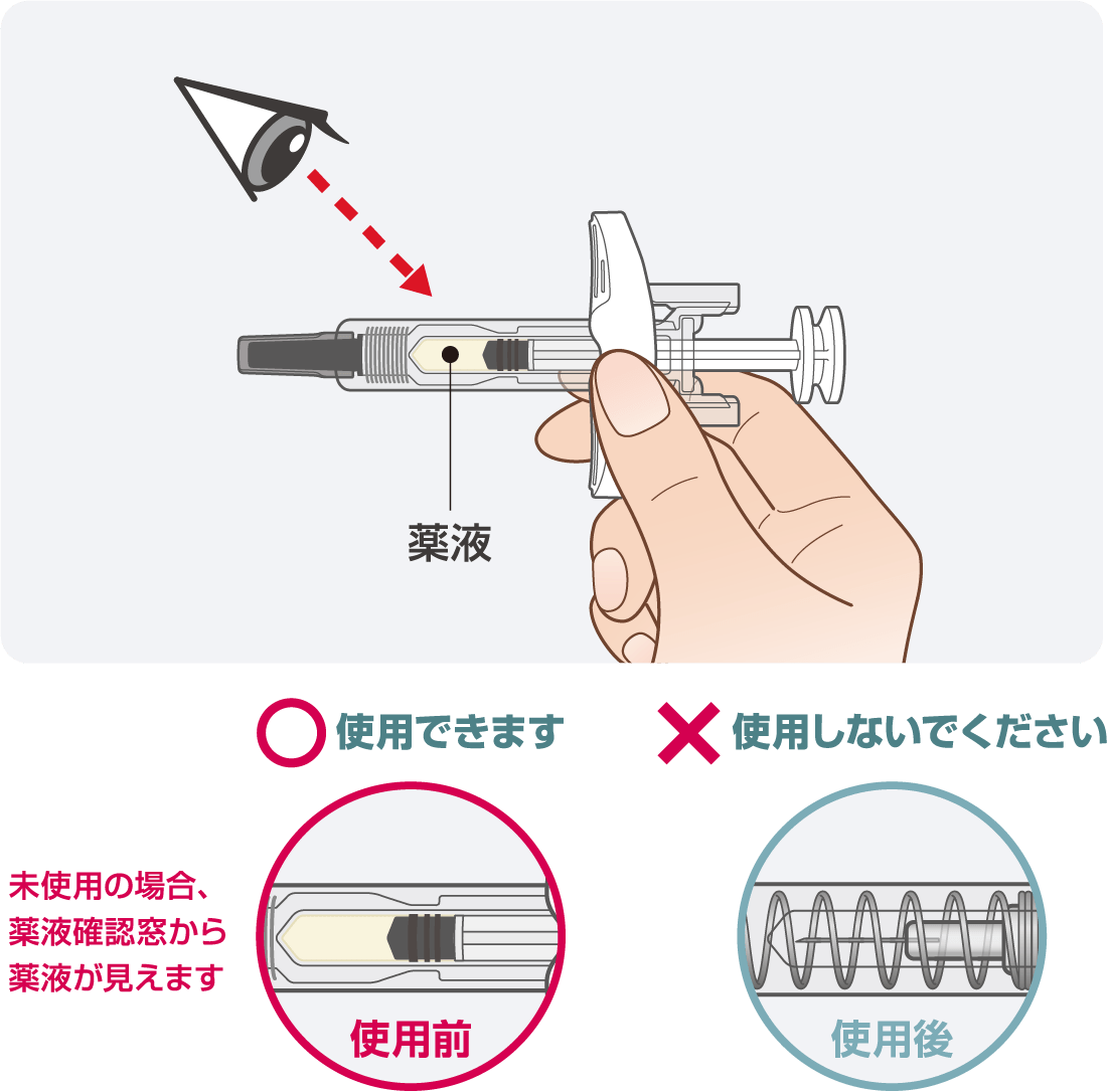 薬液を確認