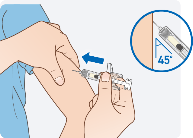 注射方法