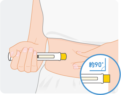 注射方法図