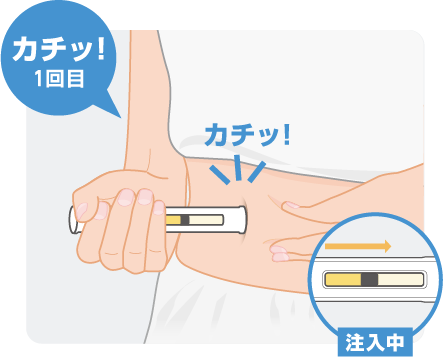 注射方法図