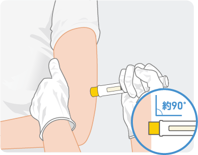 注射方法図