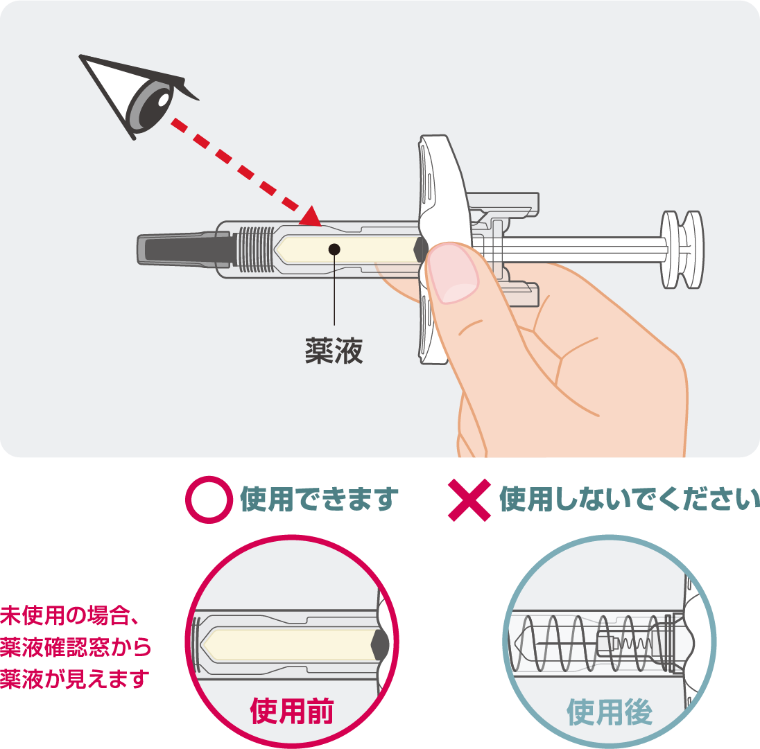 薬液を確認